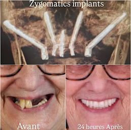 Photo n°4 de Dr. Russo Umberto à Paris (Parodontiste spécialiste des implants dentaires)