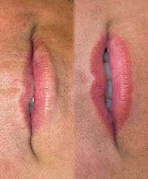 Photo n°24 de DermoLab Reims - Maquillage permanent Reims à Reims (Centre de bien-être)