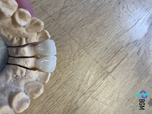 Photo n°8 de BGM Laboratoire Dentaire à Paris (Centre de prothèses dentaires)