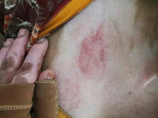 Cured within 1 week (Dr Soumya Dey's Clinic desk) 