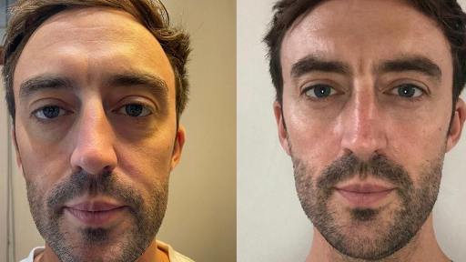 Theresa Collins Advanced Skin