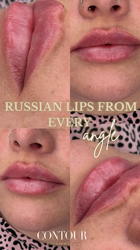 Contour Cosmetics Aesthetics Clinic