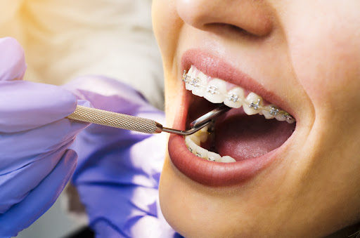 Radiant smiles begin with precision-driven orthodontic care designed to enhance both confidence a… post image