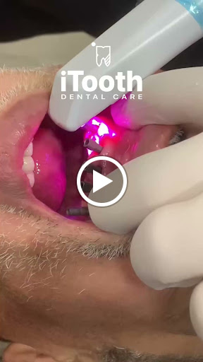 Itooth Dental Care - Dr Muhamed Areny - صورة 7