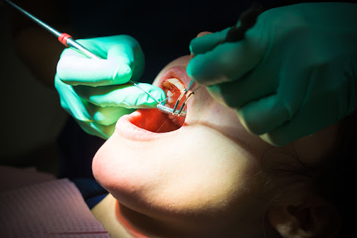 A dental abscess is a painful condition caused by a bacterial infection, often resulting from unt… post image