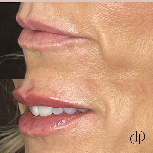 Desert Derma MedSpa: Linda Beymer, MSN-RN