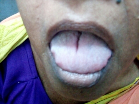 Cured within 2 weeks (Dr Soumya Dey's Clinic desk)  post image