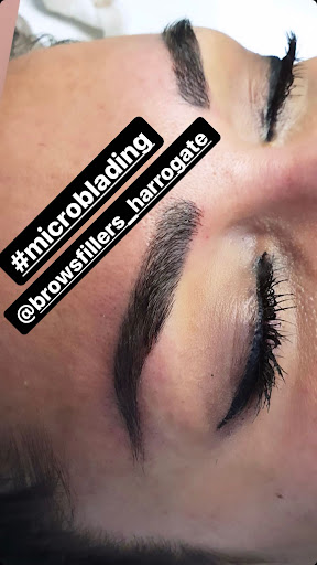 Brows Fillers Harrogate Medical Aesthetics - Thumbnail