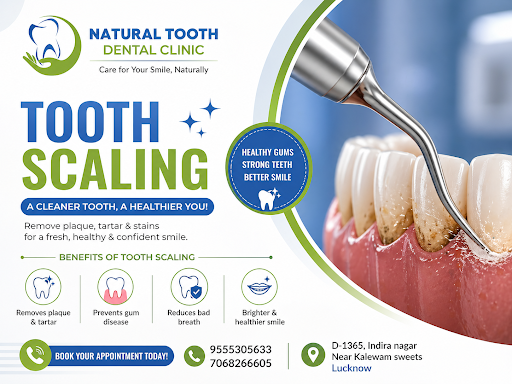 Looking for professional tooth cleaning near you? At Natural Tooth Dental Clinic, Indira Nagar Lu… post image