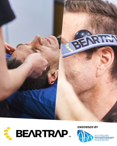Beartrap - Visual