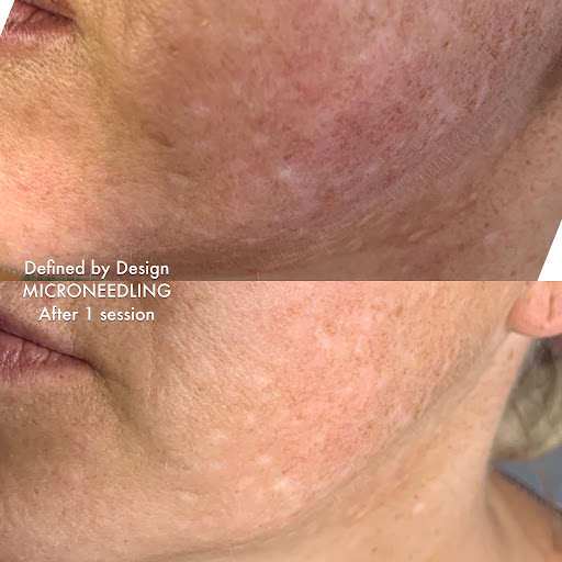 Defined by Design - Skincare + Lash Extensions - Thumbnail