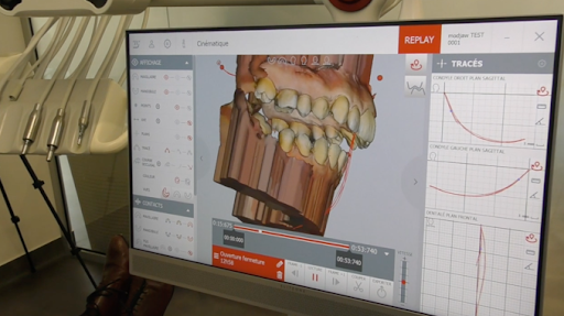 Zenith Orthodontie I Orthodontie Val d'Oise I Orthodontie Adulte et Enfants I Aligneur invisible I Esthétique du sourire - Thumbnail
