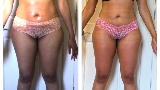Karin Slimming Massage only for women Gallery - United States