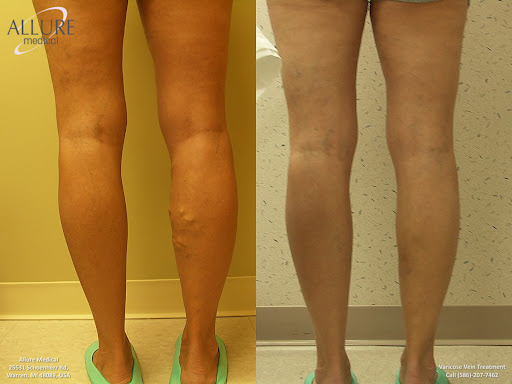 Allure Medical