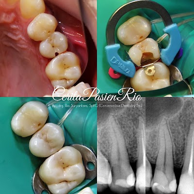 Photos of Spesialis konservasi gigi (endodontist) drg. Rio Suryantoro, SpKG