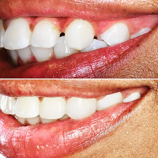 Bella Dental Dallas - Thumbnail
