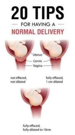 Here are some tips that may help with a normal delivery:  post image