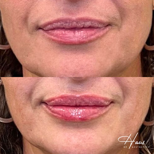 Haus of Aesthetics Provo