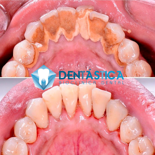 Dentástica.Cln - Thumbnail