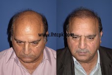 Hair Transplant & Cosmetic Centre Islamabad (LHTC)