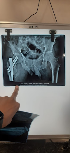 Consult Today with Dr Shashank Dongre Physiotherapist
