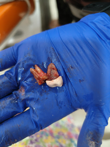 47extraction done post image