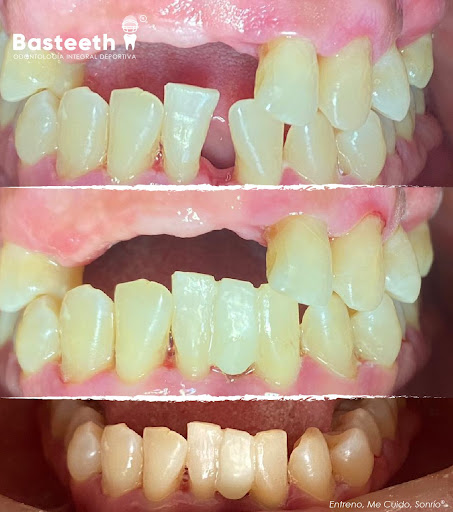 Basteeth - Visual