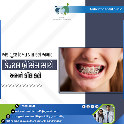affordable braces, best braces clinic near me post image
