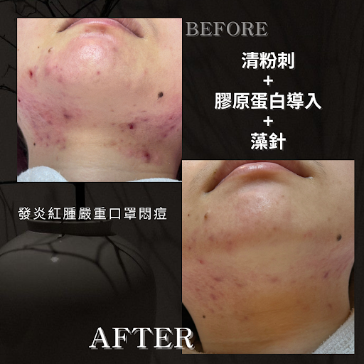 昀易美學Yunyi beauty評價、營業時間、服務項目、價格 – 專業清粉刺與皮膚管理 - Place thumbnail