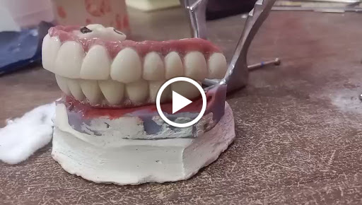 Digital impression and digital processed teeth post image