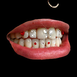 Photo n°12 de 69strass à Lyon (Dentiste cosmétique)