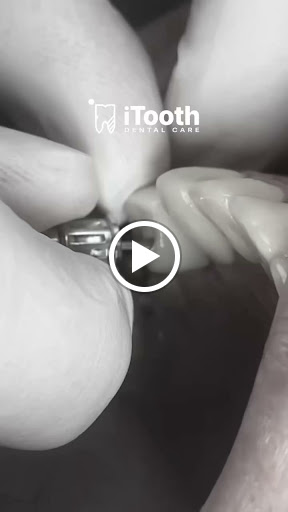 Itooth Dental Care - Dr Muhamed Areny - صورة 8