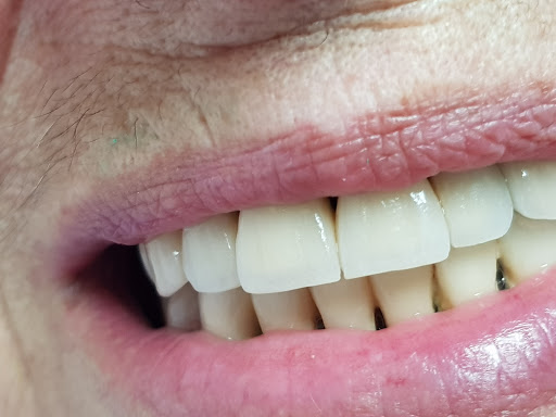 TECNODENTAL di Montagnoli Fabio LAB.PROTESI DENTALE - Thumbnail