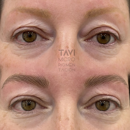 Tavi Beauty clinic - Thumbnail