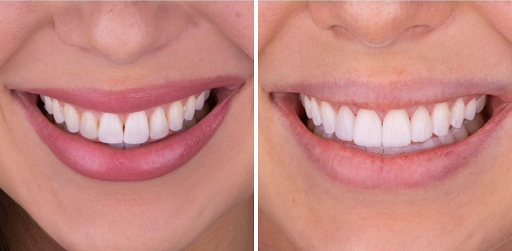 Ingenic Dental Studio - Thumbnail