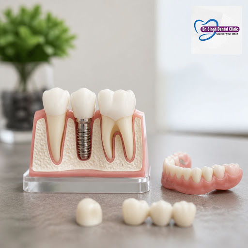 Missing or damaged teeth can affect your smile, confidence, and ability to eat comfortably. At th… post image