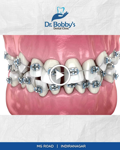 Visit Dr. Bobby’s Dental Clinic – trusted by hundreds of families for expert and compassionate de…