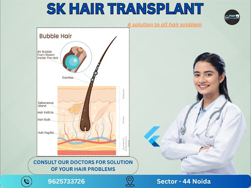 Welcome to SK Hair Transplant, the leading hair transplant clinic in Sector-44, Noida NCR, offeri… post image