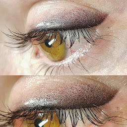 Photo n°16 de LOOK'STHETIK Maquillage Permanent & Détatouage à Levallois-Perret (Service de détatouage)