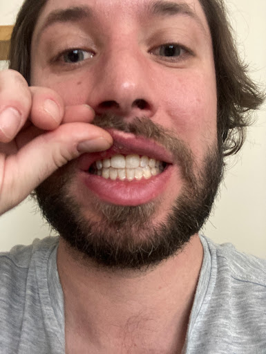 Altitude Dental - Thumbnail