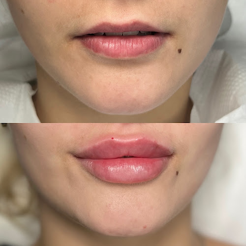 AESTHETIC Małgorzata Kuś - Salon piękności
