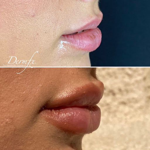 DermFx Redondo Beach - Thumbnail