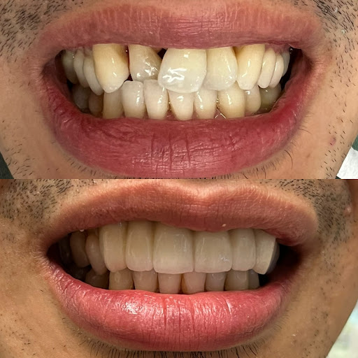 San Pablo Smiles Dentistry - Thumbnail