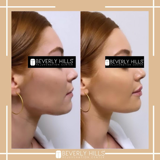 Beverly Hills Rejuvenation Center - Alliance - Thumbnail