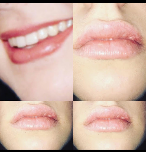 Clove Lakes Laser Center & Medical Spa - Thumbnail