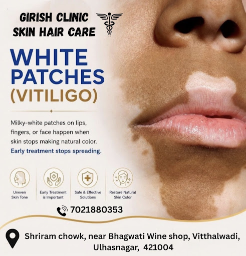 Best skin clinic Ulhasnagar post image