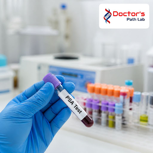 Prostate health is essential for men over 40, and a timely PSA (Prostate Specific Antigen) test c…