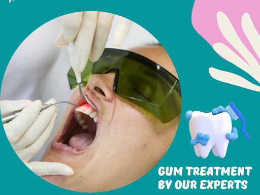 Best gum treatment in Paschim Vihar | best dental clinic in Mianwali Nagar | Best dentist in Mian…