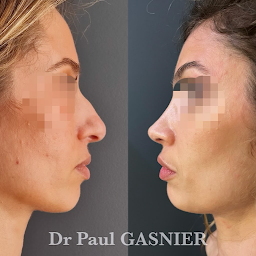 Photo n°10 de Docteur Paul GASNIER - Chirurgie esthétique à Nice (Chirurgien)