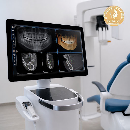 Accurate diagnosis is the first step to a healthy, confident smile. At Dr Nakra's Dental Clinic i… post image